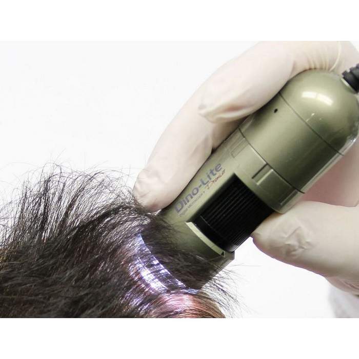 Dino-Lite TrichoScope UV